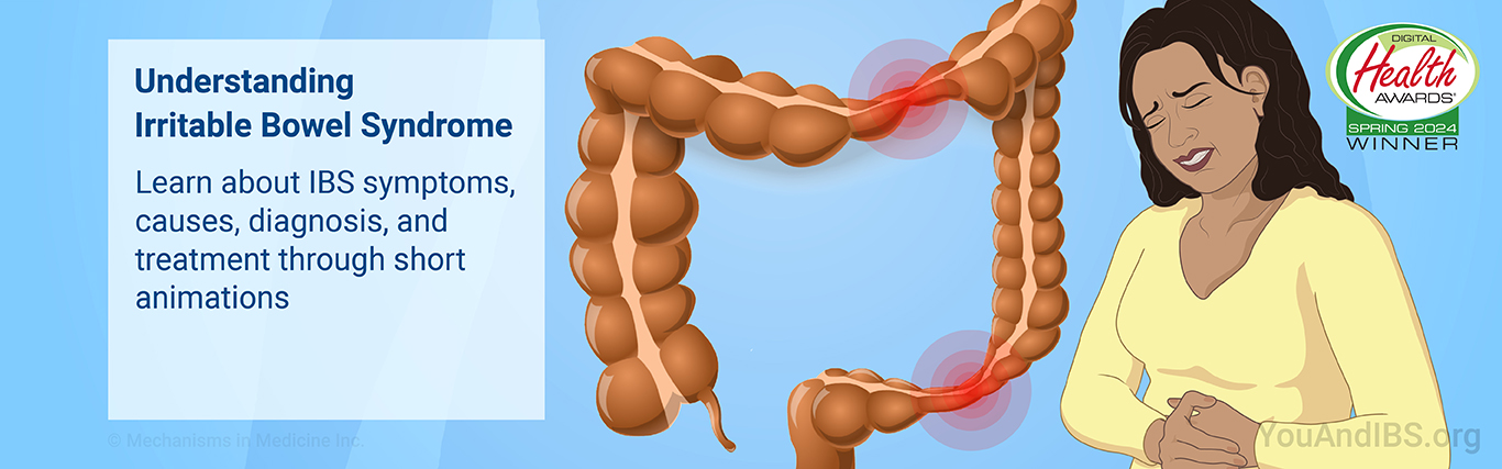 Understanding Irritable Bowel Syndrome. Learn about IBS symptoms, causes, diagnosis, and treatment through short animations.