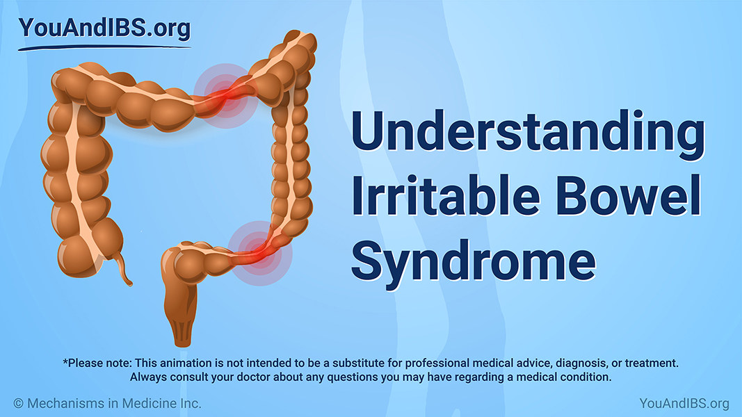 Understanding IBS