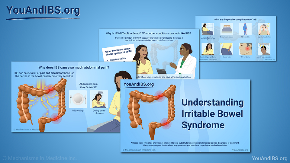 Slide Show - Understanding IBS