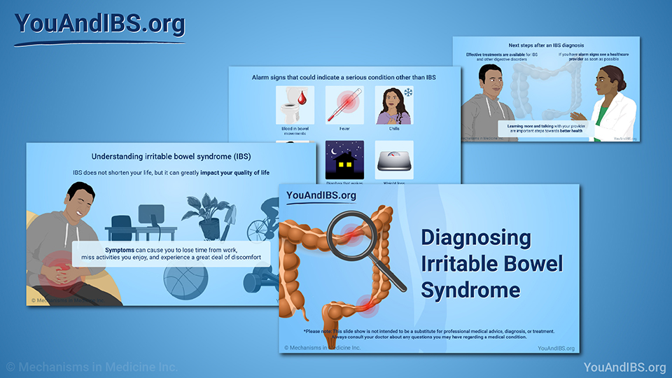 Slide Show - Diagnosing IBS