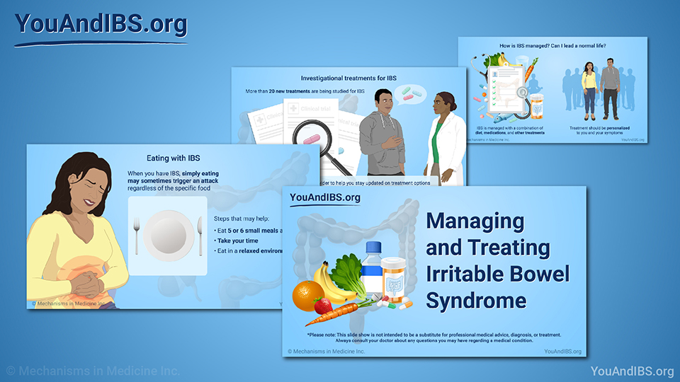 Slide Show - Managing and Treating IBS