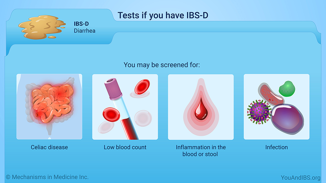 Tests if you have IBS-D