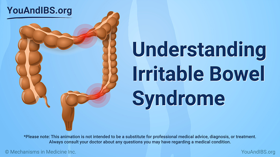 Animation - Understanding IBS