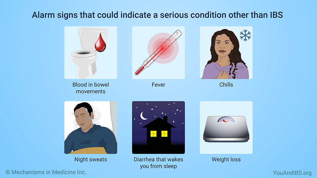 Alarm signs that could indicate a serious condition other than IBS 