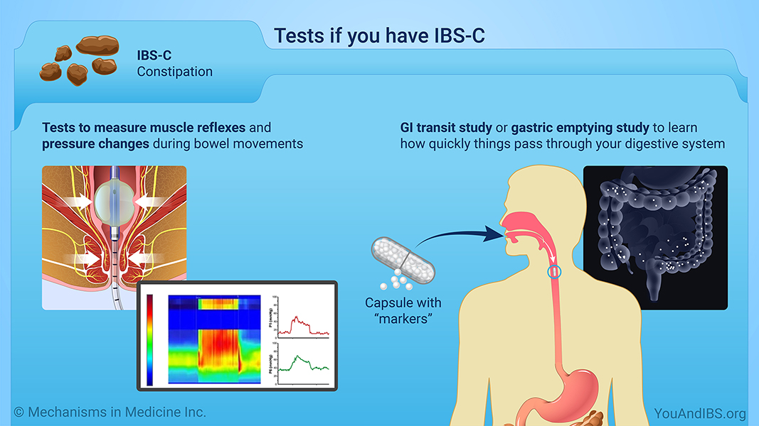 Tests if you have IBS-C
