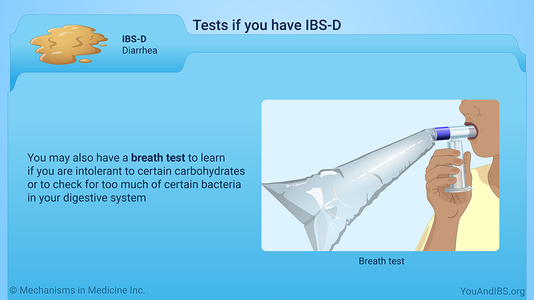 Tests if you have IBS-D