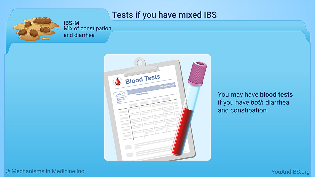 Tests if you have mixed IBS