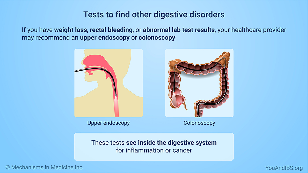 Tests to find other digestive disorders