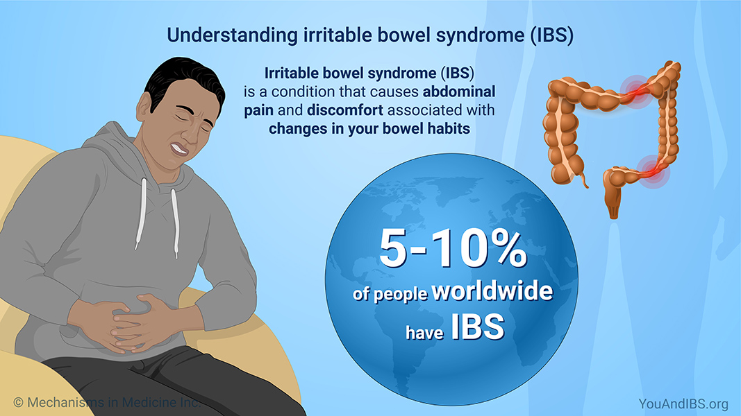 Understanding irritable bowel syndrome (IBS)