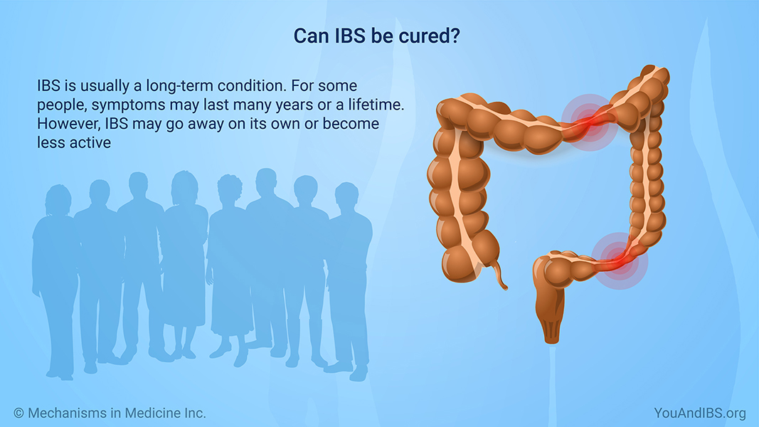 Can IBS be cured? 