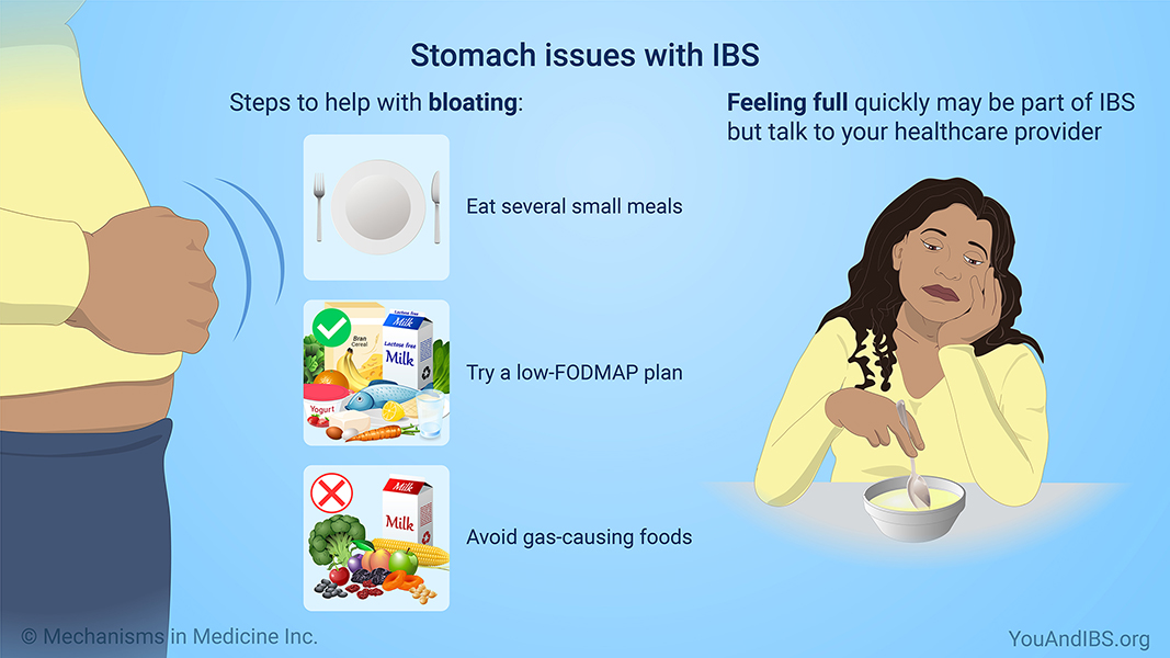 Stomach issues with IBS
