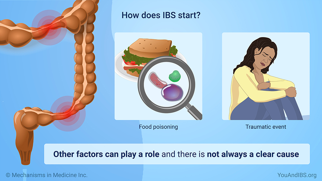 How does IBS start?