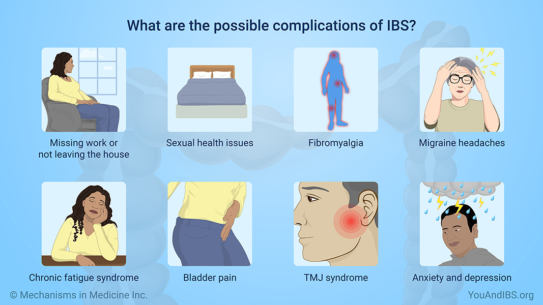 What are the possible complications of IBS?