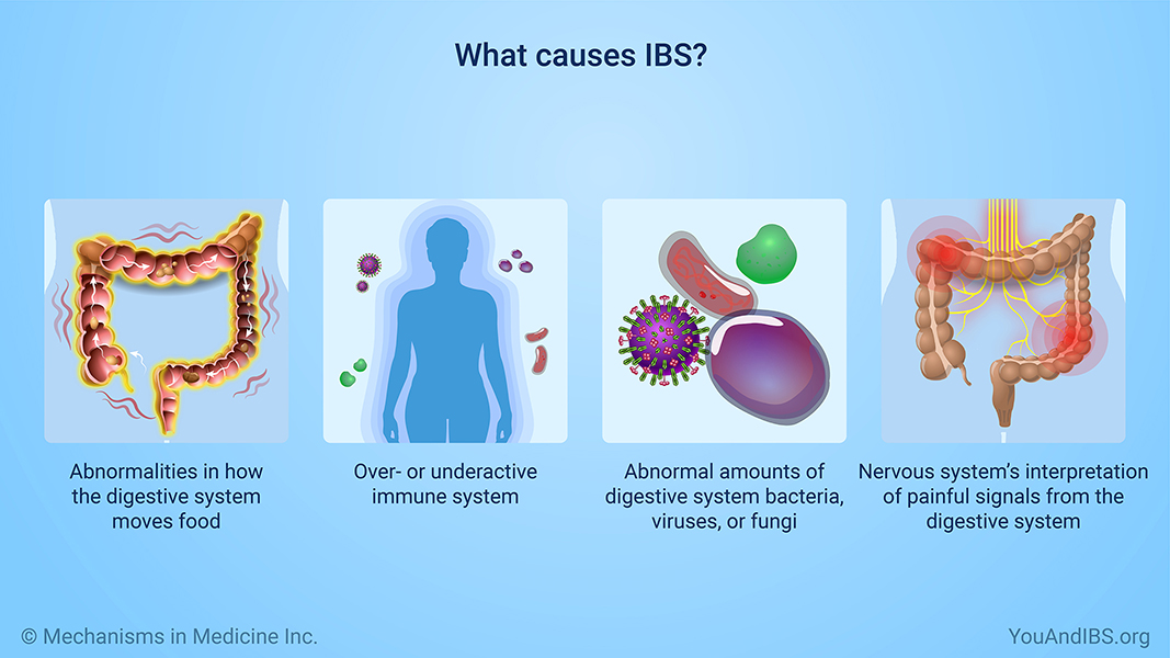 What causes IBS?