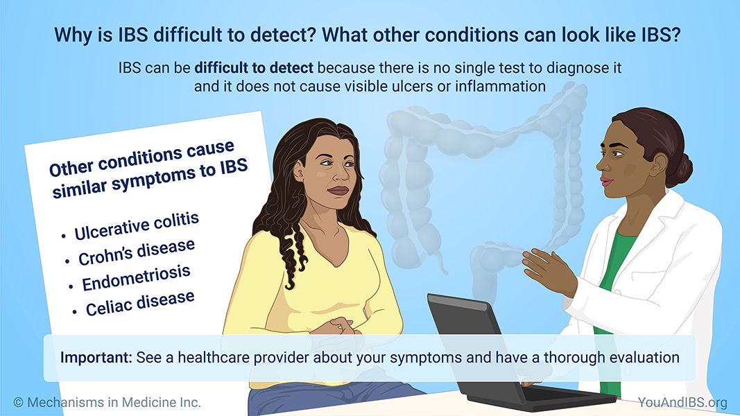 Why is IBS difficult to detect? What other conditions can look like IBS? 
