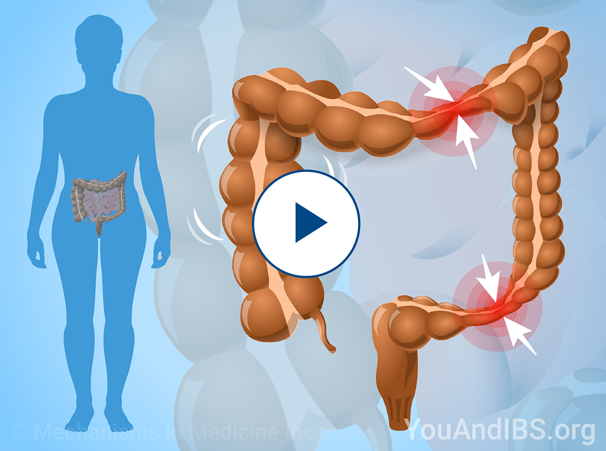 Learn about a variety of topics on IBS through short animations